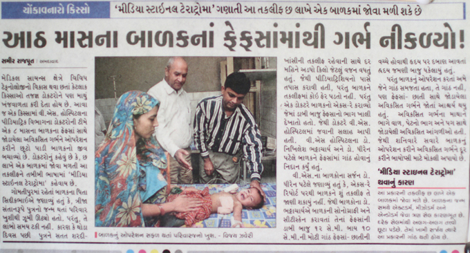 Foetus found in lungs of eight month old child